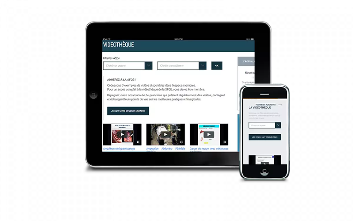 Internet-Extranet de la Société Française de Chirurgie Endoscopique